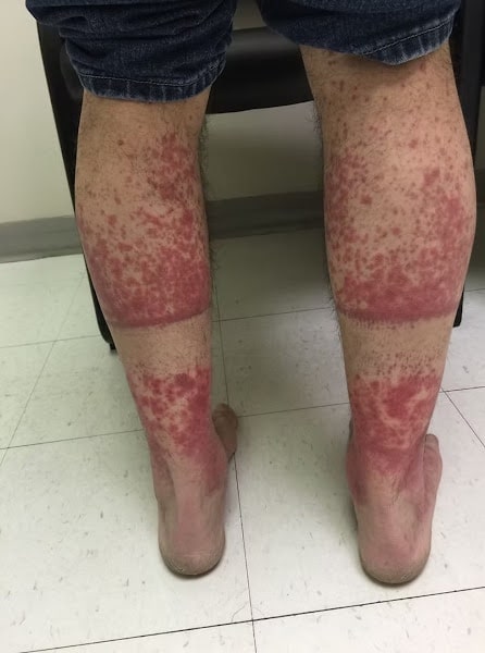 The Hidden Consequences of Sleeping with the Wrong Person