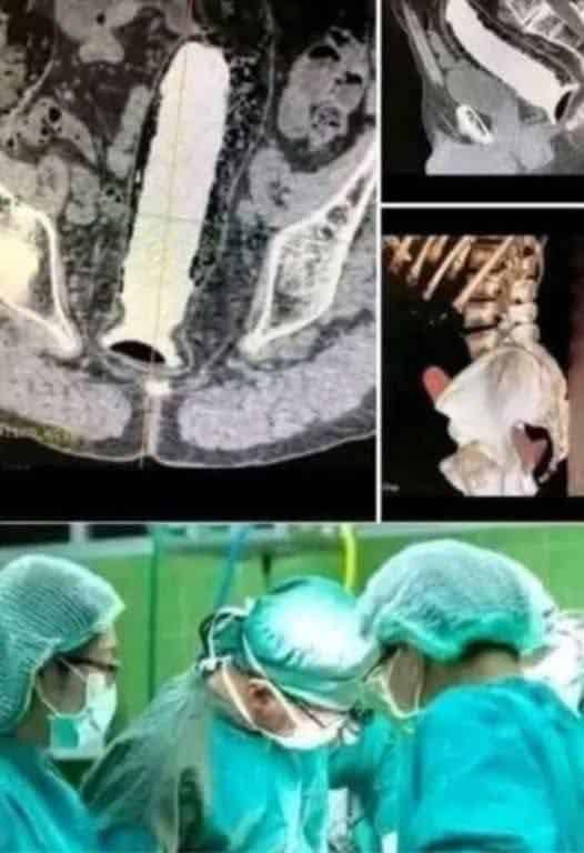 Girl was hospitalized