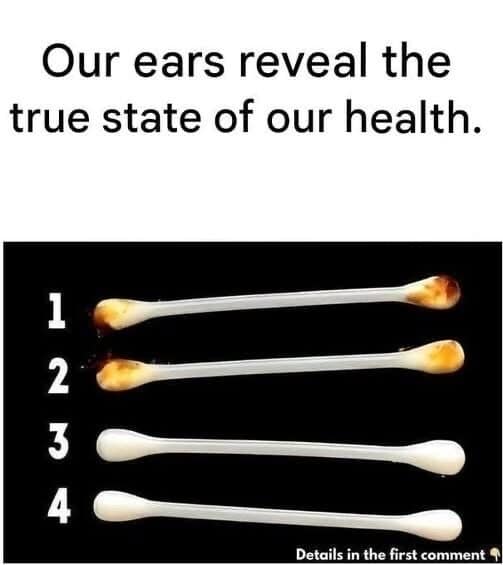 The Silent Diagnostic: What Your Earwax Reveals About Your Internal Health