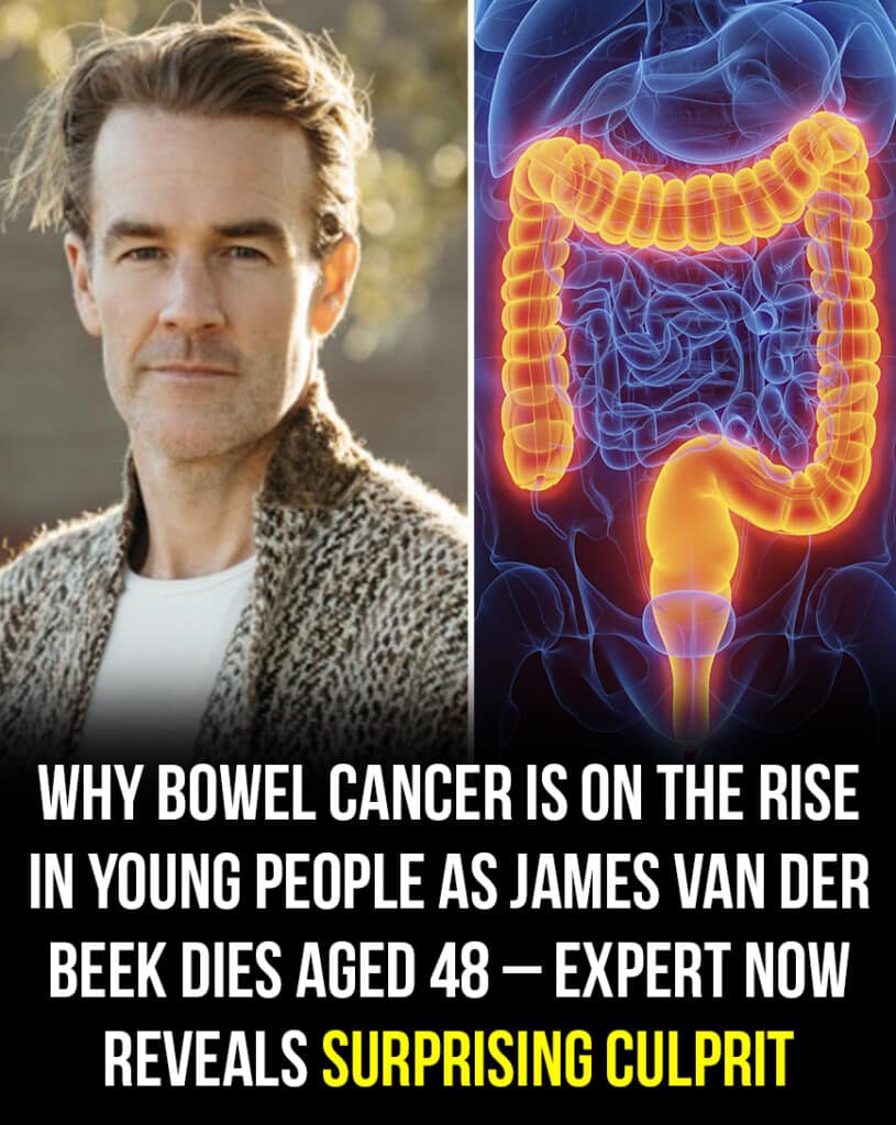 Understanding the Growing Risk of Bowel Cancer in Younger Adults