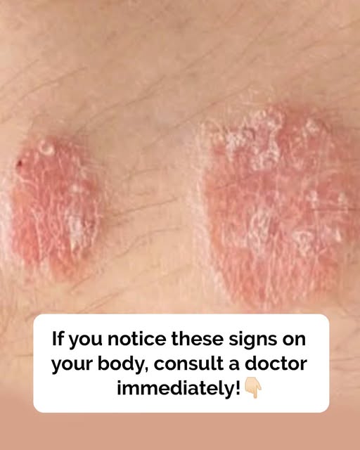 Warning signs you should never ignore on your skin