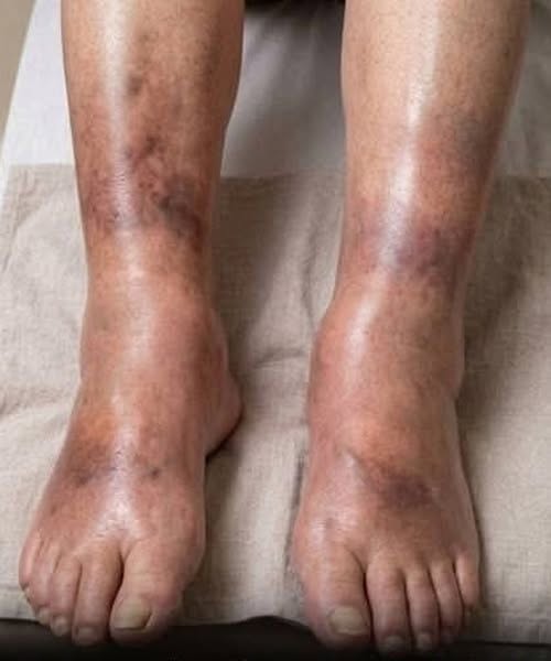 These are consequences of sleeping with…