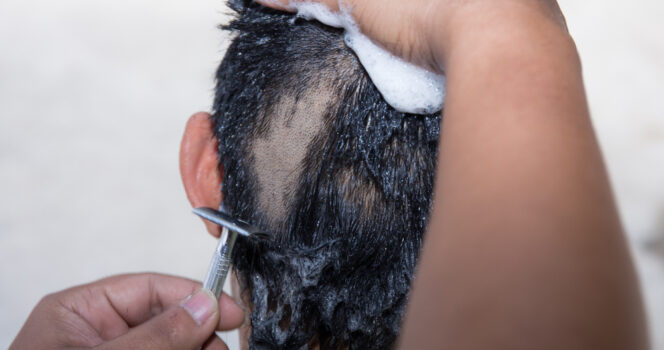 Psychologist weighs in on mom shaving daughter’s head for bullying